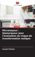 Micronoyaux: biomarqueur pour l'évaluation du risque de transformation maligne