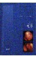 Endometrial Carcinoma and Precursors