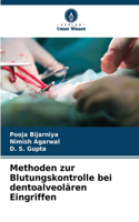 Methoden zur Blutungskontrolle bei dentoalveolären Eingriffen