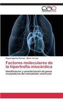 Factores moleculares de la hipertrofia miocárdica