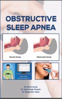 Obstructive Sleep Apnea