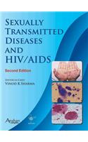 Sexually Transmitted Diseases and HIV & AIDS 2e