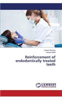Reinforcement of endodontically treated teeth