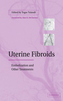 Uterine Fibroids: Embolization and Other Treatments