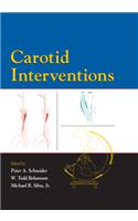 Carotid Interventions