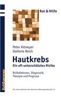 Hautkrebs - Ein Oft Unterschatztes Risiko