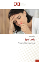 Epistaxis