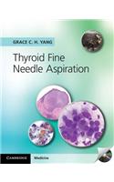 Thyroid Fine Needle Aspiration