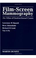 Film-Screen Mammography