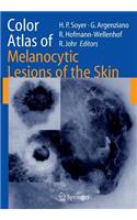 Color Atlas of Melanocytic Lesions of the Skin