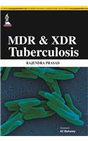 MDR & XDR Tuberculosis
