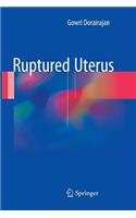 Ruptured Uterus