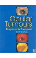 Ocular Tumours: Diagnoisis & Treatment
