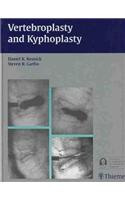 Vertebroplasty and Kyphoplasty