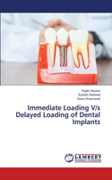 Immediate Loading V/s Delayed Loading of Dental Implants