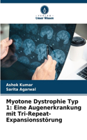 Myotone Dystrophie Typ 1