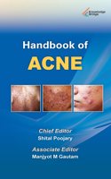 Handbook of Acne