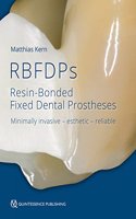 Rbfdps