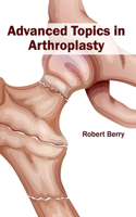 Advanced Topics in Arthroplasty: (English)
