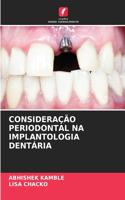 Consideração Periodontal Na Implantologia Dentária