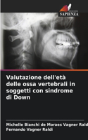 Valutazione dell'età delle ossa vertebrali in soggetti con sindrome di Down