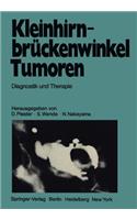 Kleinhirnbrückenwinkel-Tumoren