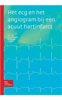 Het ECG En Het Angiogram Bij Een Acuut Hartinfarct