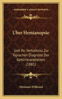 Uber Hemianopsie