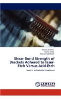 Shear Bond Strength of Brackets Adhered to laser-Etch Versus Acid-Etch