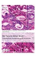 Feind in deiner Brust. Früherkennung und Behandlung von Brustkrebs