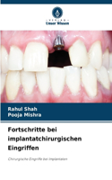 Fortschritte bei implantatchirurgischen Eingriffen