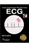 ECG