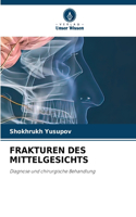 Frakturen Des Mittelgesichts