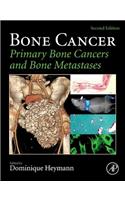 Bone Cancer
