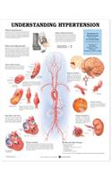 Understanding Hypertension Anatomical Chart