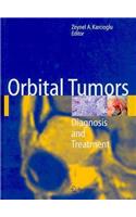 Orbital Tumors: Diagnosis and Treatment