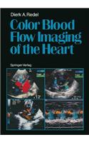 Color Blood Flow Imaging of the Heart