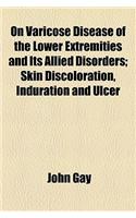 On Varicose Disease of the Lower Extremities and Its Allied Disorders; Skin Discoloration, Induration and Ulcer