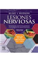 Kline Y Hudson. Lesiones Nerviosas