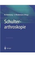 Schulterarthroskopie