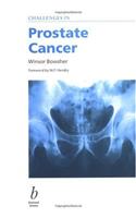 Challenges in Prostate Cancer