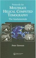 Protocols for Multislice Helical Computed Tomography