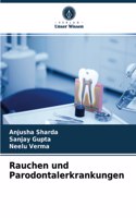 Rauchen und Parodontalerkrankungen