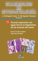 Puncion aspiracion con aguja fina en el diagnostico de los tumores de hueso: Cuadernos de citopatologia-11