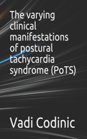 The varying clinical manifestations of postural tachycardia syndrome (PoTS)