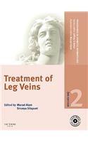 Treatment of Leg Veins