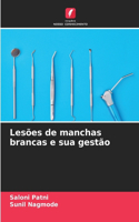 Lesões de manchas brancas e sua gestão