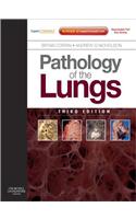 Pathology of the Lungs E-Book