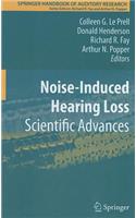 Noise-Induced Hearing Loss