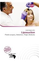 Liposuction